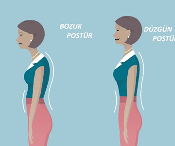 Duruş Bozukluğunda 